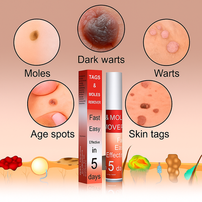 Tags & Moles Remover (Buy 1 Get 1 Free🔥🔥)